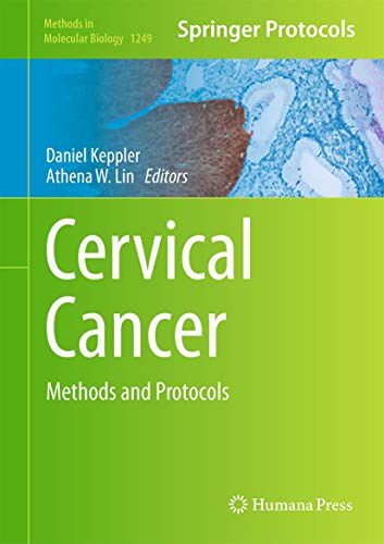 Cervical Cancer view 2