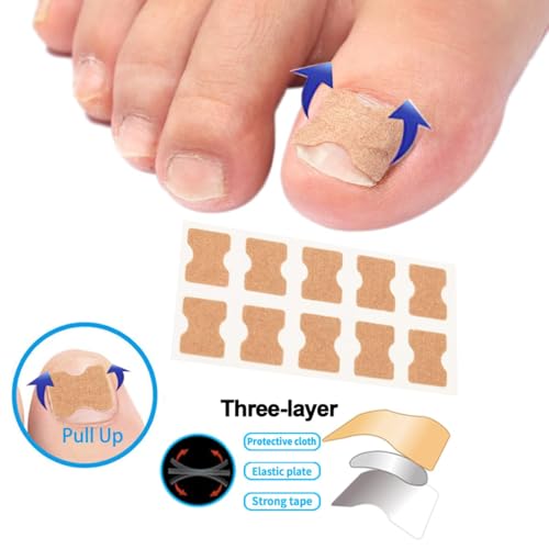 Image of druenza Ingrown Nail Corrector Set, Ingrown Toe Nail Remover & Toenail Correction Tool 20 Strips with Gentle Adhesive 36 Breathable Patches for Daily Nail Care & Home Foot Care Solution