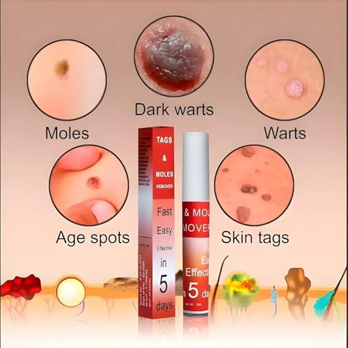 Image of Pack of 2 Wart, Ointment, Skin Tags & Moles Remover For Face & Body | Massa & Ointment Remover For All Skin | Skin Tag Remover - Fast, Easy & Effective Formula for All Skin Type (2 Units)