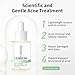 10% Salicylic Acid Serum, Acne Treatment for Face, 30ml/1 oz, Minimize Pores, Active Skin Repair, Relieve Redness Blemish, Pimples Remover, Skin Barrier Repair for Acne Prone Sensitive Skin Care