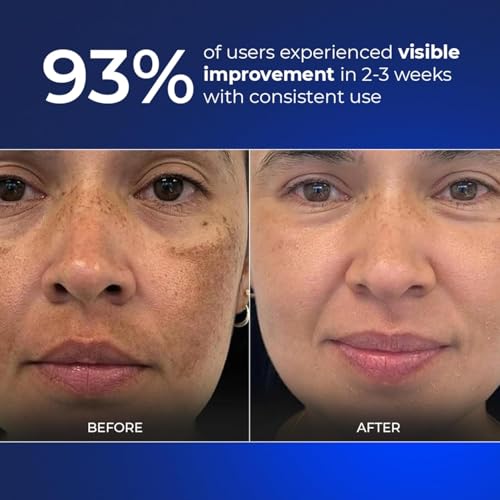 Image of Aqueria Brightening & Moisturizing Multi-Active French Sunscreen SPF 50 PA++++ | In-Vivo /In-Vitro Tested | 5% Niacinamide, 5 Ceramides & Vitamin E | Modern UV Filters | Broad Spectrum UVA /UVB & Blue Light Protection | Lightweight, No White Cast, Sweat Resistant | Suitable for Daily Use | For Normal, Dry & Sensitive Skin | 100g