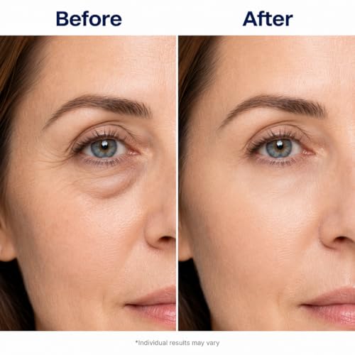 Image of Under Eye Patches for Dark Circles: 30 Pairs Enaskin Naturals Retinol Collagen Eye Gels Mask - Reduce Wrinkles Puffy & Bags - Skin Treatment Pads - Anti Aging Moisturizer For Women (Blue)