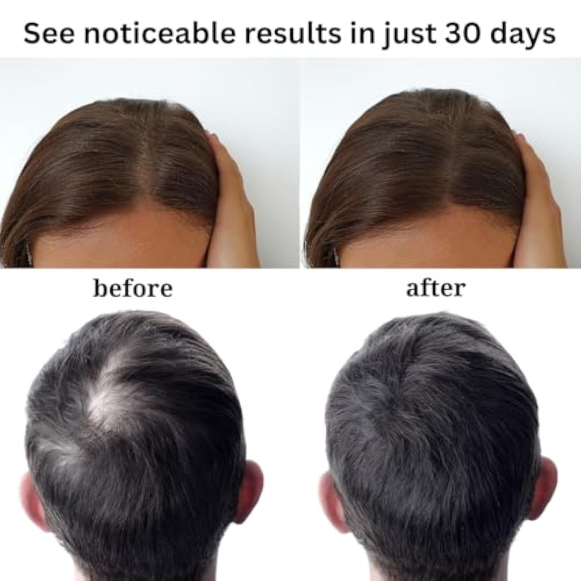 Advanced Hair Growth Serum with Moringa & Amla