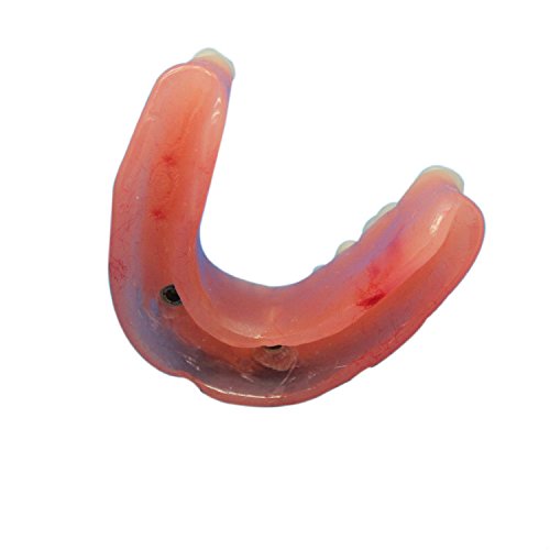 Doc.Royal Dental Study Teaching Model Teeth Implant Repair Model for Dentist