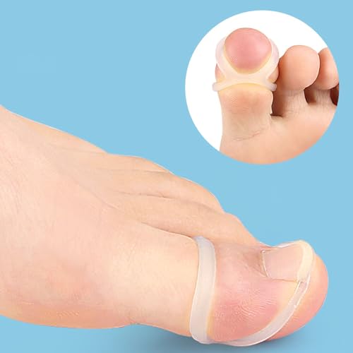 Corretor de unhas dos pés, 10 peças, ferramenta de correção de unhas encravadas de silicone reutiliz