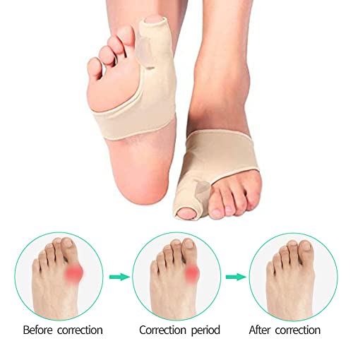 KARELLS Hallux Valgus Correcteur Jour Nuit, Gros Redresseur Orteil, Gros Redresseur Orteil Manchons de Protection pour Amortir Hallux Valgus, Hammer Toe, Soulagement de Douleur, 1 paires