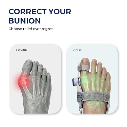 Image of Bunion Corrector for Women and Men Adjustable Toe Straightener Support