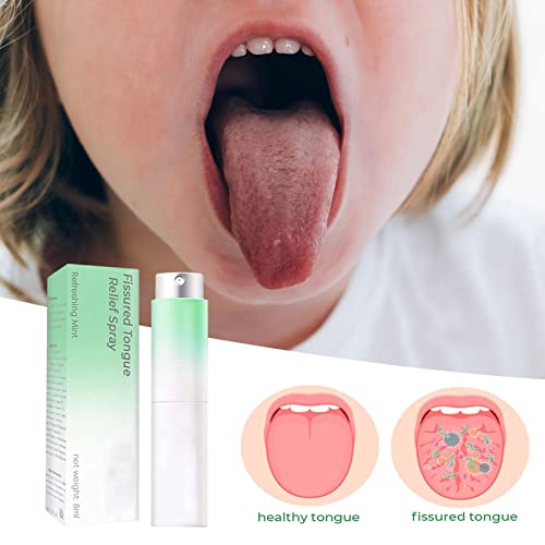 Refrescante hálito - 0,34oz Mint Breath Spray,Spray refrescante para alívio da língua com menta para