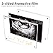 DEYIXUN Acrylic Ultrasound Picture Frame, Bright Photo Frame, Sonogram Love at First Sight Baby Keepsake Baby Announcement, Birth Information, Expecting Mom Parents to be Unique Gifts for Pregnant