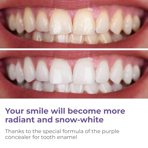 Image of Brightening White Teeth Whitening Foam - 50ml Colour Corrector, Removes Stains, Enamel Safe, Fresh Breath, Easy Home Use for a Radiant Smile