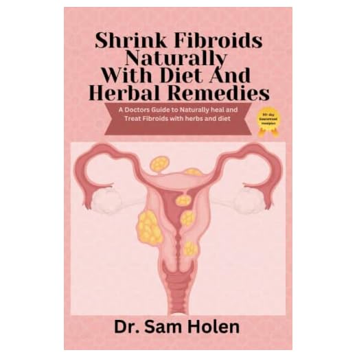 Shrink Fibroids Naturally With Diet & Herbal Remedies: A Doctors Guide to naturally heal Treat herbs diet. Proven Methods To Eliminate, Prevent leiomyoma Miracle cure myoma treatment remedy cookbook