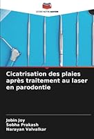 Cicatrisation des plaies après traitement au laser en parodontie 6205311887 Book Cover