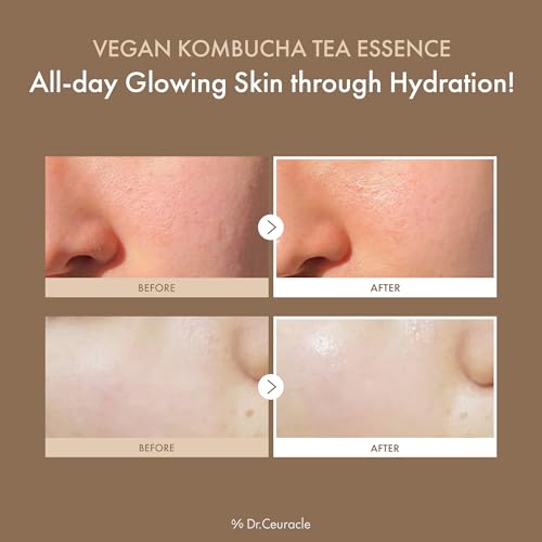 Dr. Ceuracle Dr.Ceuracle Vegan Kombucha Tea Essence - Hydrating Milky Toner with Kombucha Tea Extract, Centella Asiatica, Ceramide, Korean Skincare Essence (150 ml / 5.07 fl. oz.)
