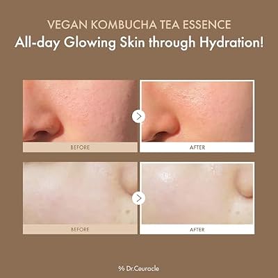 Dr.Ceuracle Vegan Kombucha Tea Essence - Hydrating Milky Toner with Kombucha Tea Extract, Centella Asiatica, Ceramide, Korean Skincare Essence (150 ml / 5.07 fl. oz.)