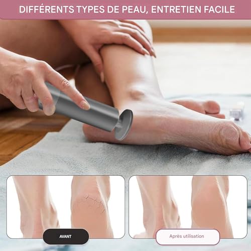 Ponceuse pédicure avec meule exfoliante rotative anti-callosités efficace - 2