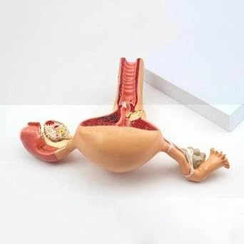 Pathological Uterus Ovary Anatomical Model Anatomy Cross Section Study Tool