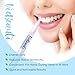 VieBeauti Teeth Whitening Pen Gel: No Sensitivity with Remineralizing Pen, Carbamide Peroxide Removes