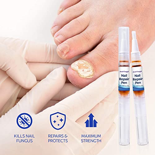 Nail Fungus Treatment For Toenail, Fingernail And Toenail Fungus Treatment Extra Strength, Toe Nail Restoring Solution, Cure Repair Pens For Nails (2 Pcs) #TOP1
