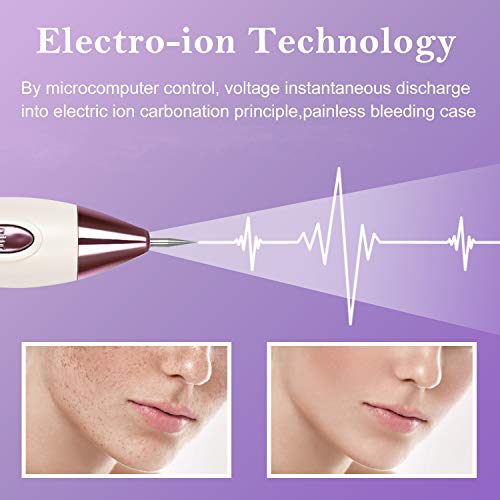 Top 10 Best acne laser pen Reviews NecoleBitchie