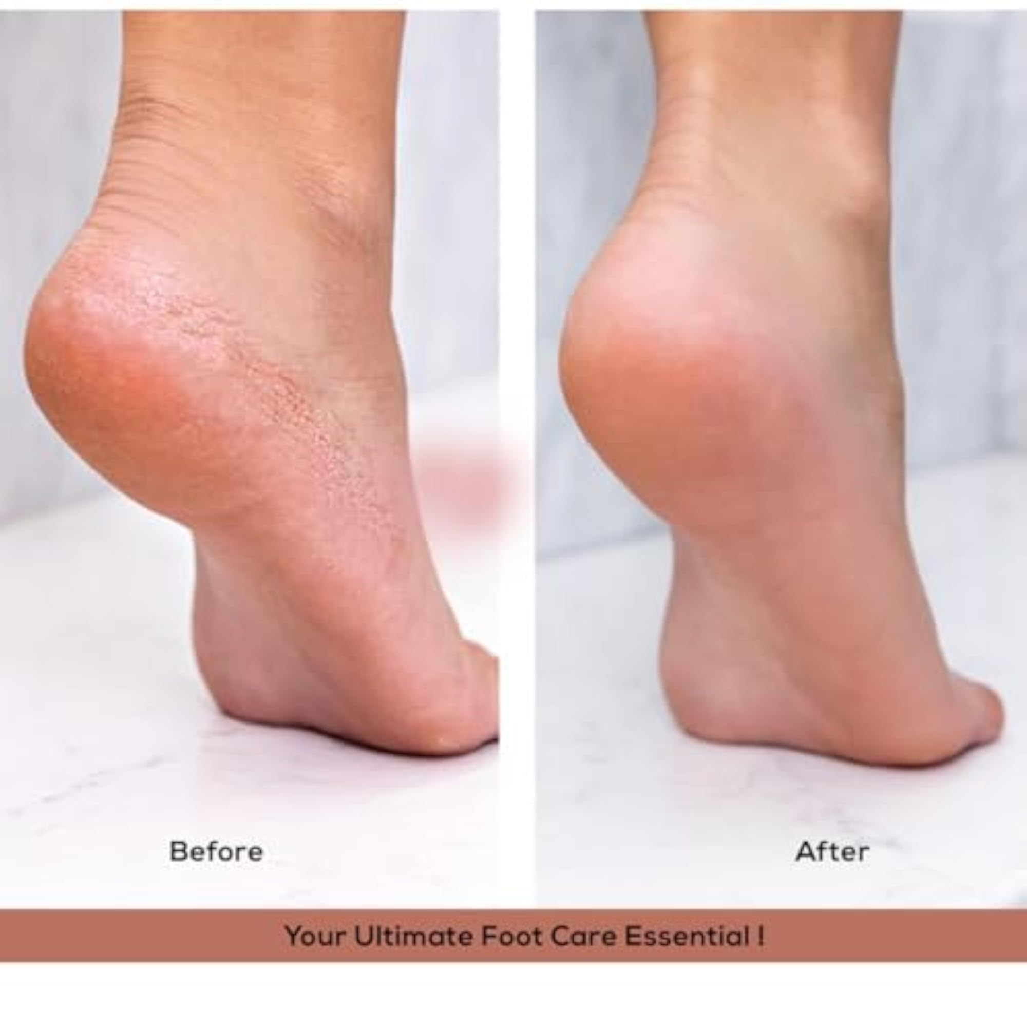 Professional Callus Remover Foot File, Dead Skin Remover