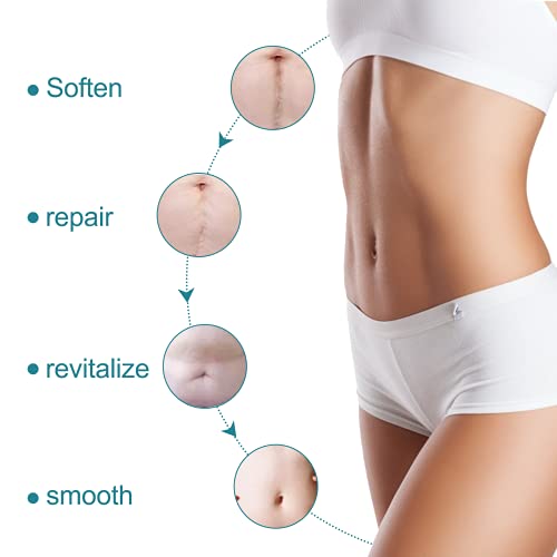Find Back JH-SCARSHEET Silicone Scar Sheets thumb #7