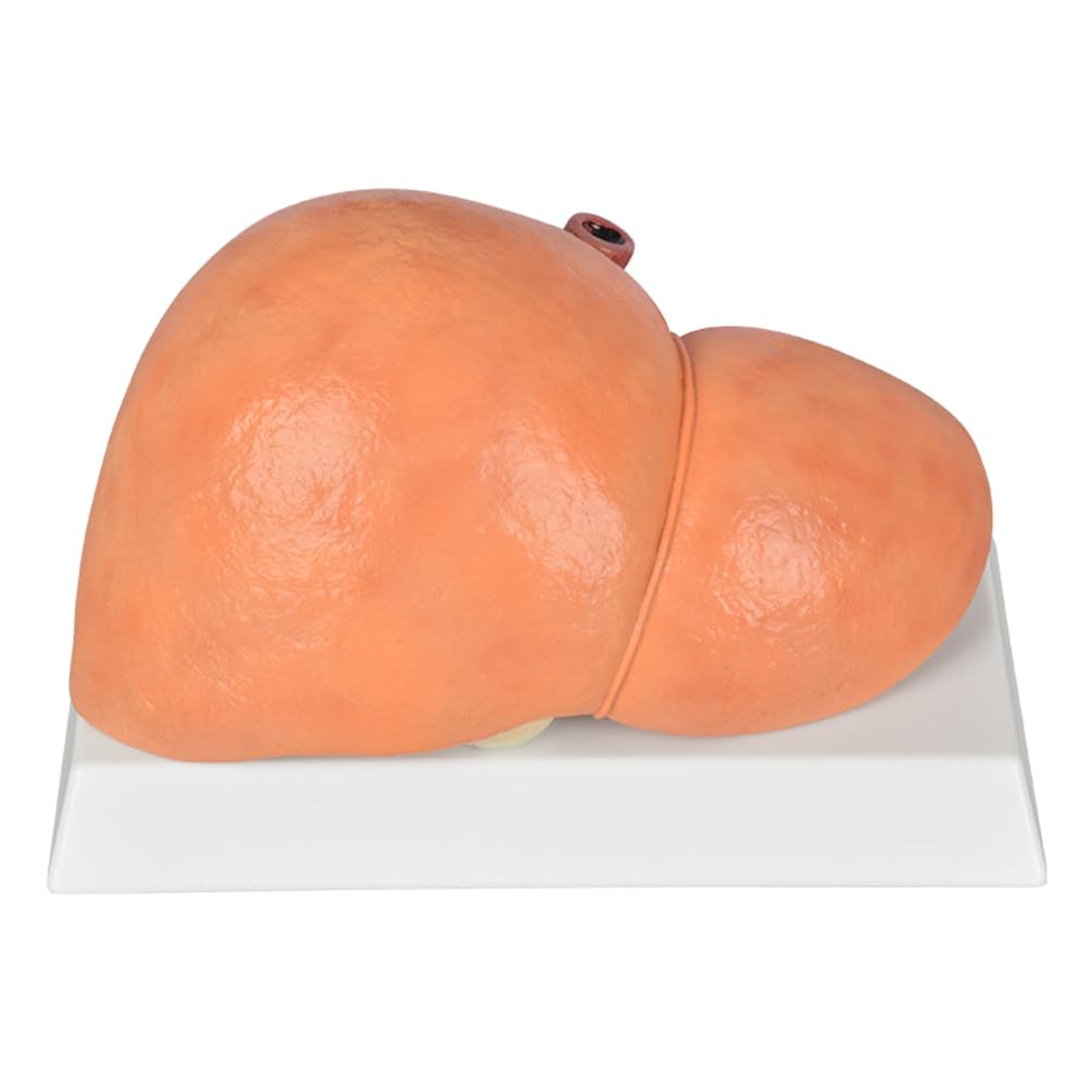 YRQMGSF Adult Normal Liver Model - Pathological Whole Liver Model - Silicone Human Internal Organs for Medical Research and Teaching
