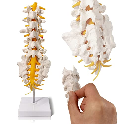 Image of EVOTECH SCIENTIFIC Lumbar Spine Anatomy Model with Sacrum and Spinal Nerves, Didactic Replica of Lumbosacral Section with Nerves and A Herniated Disc At L4, Includes Base for Medical Teaching Display