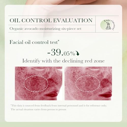 6pcs-Avocado-Skincare-Kit-Skin-Care-Gift-Set-with-Facial-Cleanser-Toner-Lotion-Face-Serum-Face-Cream-Eye-Cream-For-Hydrating-Skin-Anti-Aging-Skin-For-Women-Teen-Girls-Large-6-Count