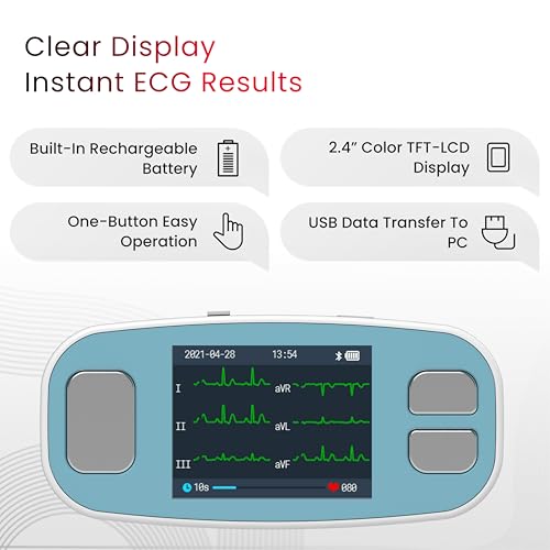 Image of CONTEC PM20 Bluetooth Portable ECG /EKG Monitor - 6-Lead Heart Rhythm & Rate Recorder, 2.4″ Color Display, Cloud Storage & App Connectivity
