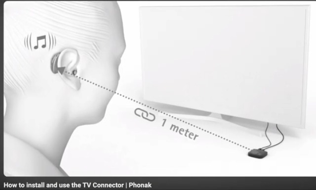 Amazon.com: Hearing Aid Accessory Phonak TV Connector for Hearing