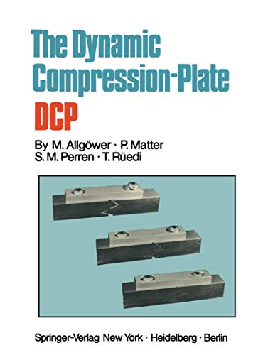 The Dynamic Compression Plate DCP view 2