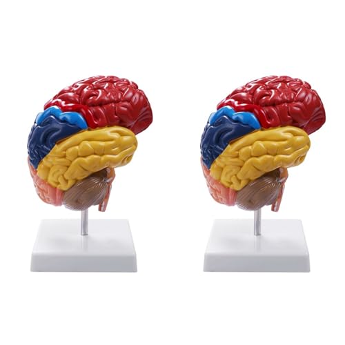 Modèle anatomique cérébral 1:1 pour éviter les erreurs de dissection