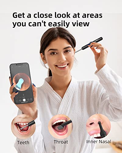 Bebird R1+ Ear Wax Removal Tool With Inspection Kit, Ear Cleaner With 300W Ear Camera, 1080P Ear Scope Otoscope, 7 Replacement Tips For Ear Pick, Safer Detachable Ear Scoop For Earwax Removal #TOP4