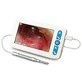 デジタル耳鏡4.3インチ1280PHDLCDスクリーン耳鏡内視鏡