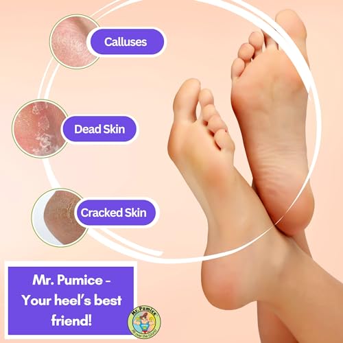 Mr. Pumice PB400-12 Ultimate Pumi Bar 2-In-1 Dual Grit (Medium + Coarse) Callus Remover thumb #4