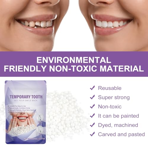 Image of Tooth Repair Kit,Moldable Beads for Teeth Repair,DIY Tooth Filling Repair Kit Fixing The Missing and Broken Replacements, DIY Natural Filling Fake Teeth,Halloween Vampire Teeth Fangs (100ML)