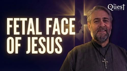 Fetal Face of Jesus