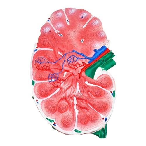 Human Lymph Node, Incredibly Detailed Model,Two Sided to Show Key