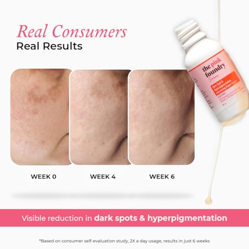 Image of The Pink Foundry Dark Spot & Hyperpigmentation Serum with 3% Tranexamic Acid 2% Alpha Arbutin 3% Niacinamide | Fades Appearance of Acne Marks | All Skin Types | For Men & Women | Lightweight & Fast Absorbing | 15 ml