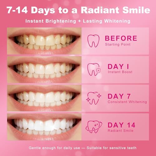 Image of Teeth Whitening Kit with LED Light Tray for Sensitive Teeth, 5 Tooth Whitening Pen Gel Pain Free and Enamel Safe, Teeth Whitener at Home Up to 1-9 Shades Whiter in 1-2 Weeks