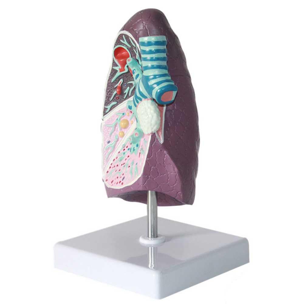 Modèle de poumon fumé en classe de sciences pour illustrer les effets du tabagisme