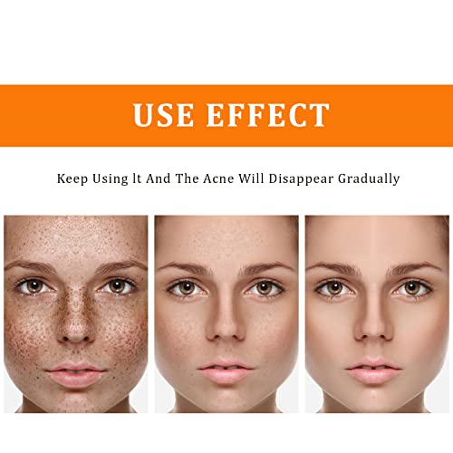 YAFUSIPE Toner for Dark Spots Turmeric Dark Spot Corrector, Facial Toner for Acne Prone Skin, Dark Spot Correcting Hydrating Face Toner for Women Moisturizing for All Skin Type- 3.4 OZ
