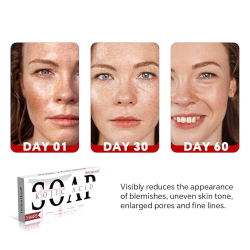 Travel friendly kojic acid soap bar