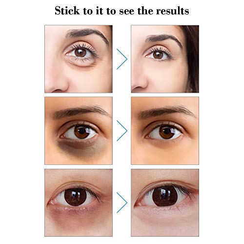 Máscara de olho, Romacci Máscara ocular Ácido hialurônico sob as almofadas dos olhos sob as bolsas d