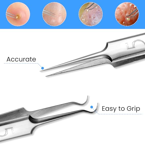 6 Pcs Blackhead Remover Tweezers Popper Remover Tool Kit Ingrown Hair Extractor Clip Set Skin Popping Removing Tools for Nose Eye Face Beauty Care Women Girls (M, Count, 6)