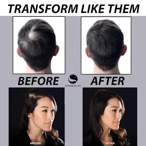 Image of Hair Fiber Brown - Keratin Thick Fiber & Hair Building Fibre for Men & Women - Instant Concealer & Filler powder for Thinning Hairline & Bald Spots (27.5g) (Brown)