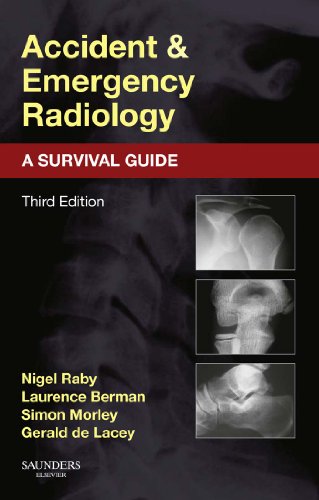 Accident and Emergency Radiology: A Survival Guide