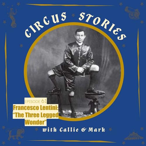 Francesco Lentini: The Three Legged Wonder