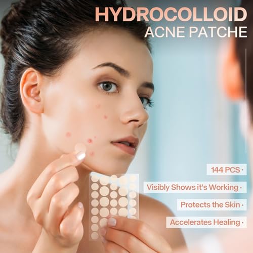 Shmian 144 adesivos de espinhas para rosto, adesivos de espinha hidrocolóide Ace para dia e noite