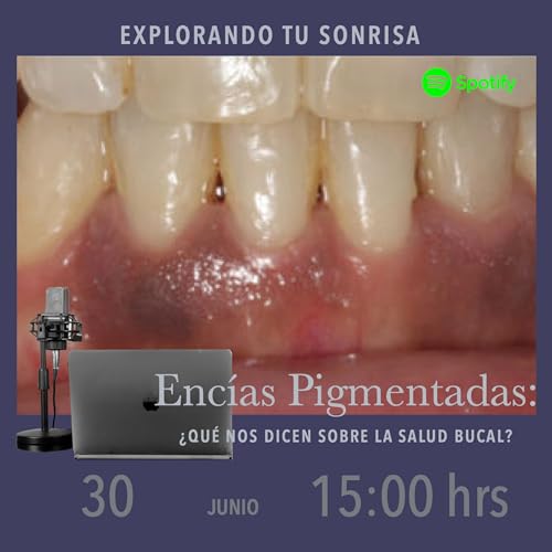 Enc&iacute;as Pigmentadas: &iquest;Qu&eacute; nos Dicen sobre la Salud Bucal?